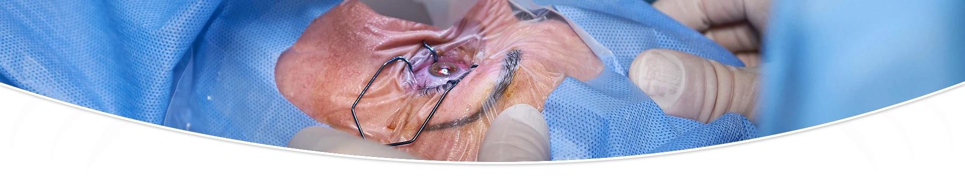 Oftalmología quirúrgica - Cirugía del segmento anterior Oftalmología quirúrgica - Cirugía del segmento anterior