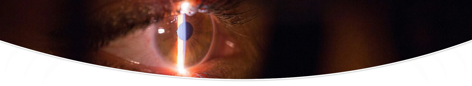 Oftalmología avanzada - Tratamiento del glaucoma ocular Oftalmología avanzada - Tratamiento del glaucoma ocular